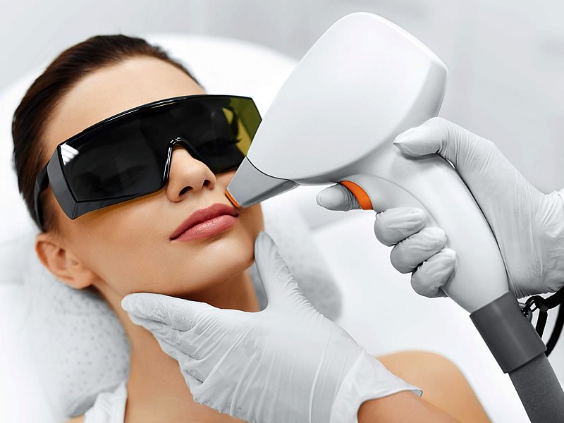 Laser Hair Removal Treatment