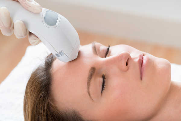 IPL Photofacial