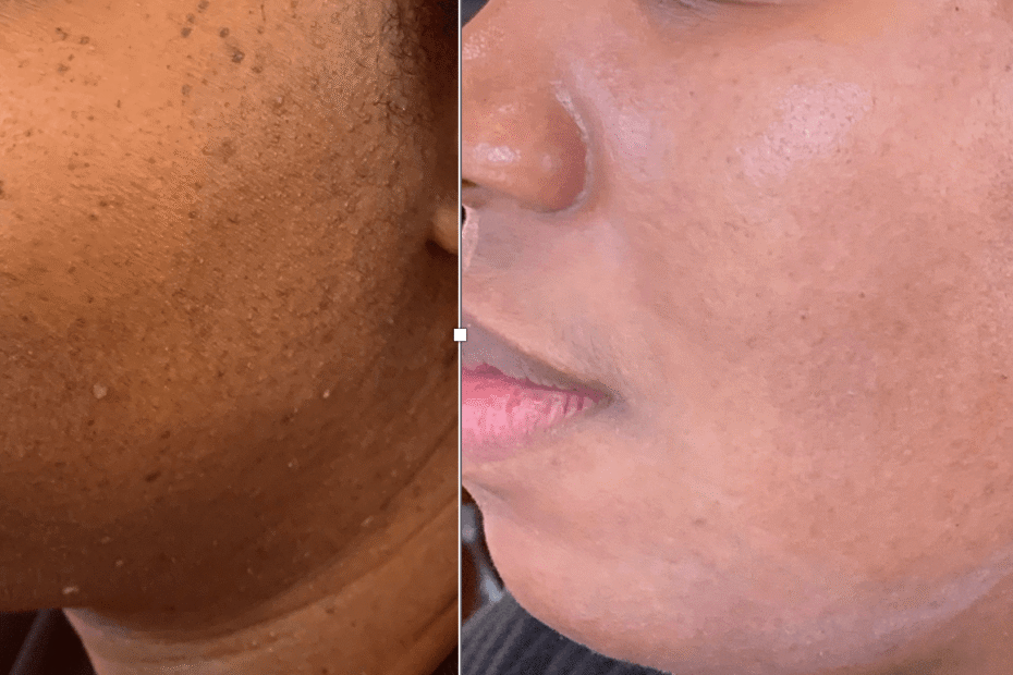 skin brightening